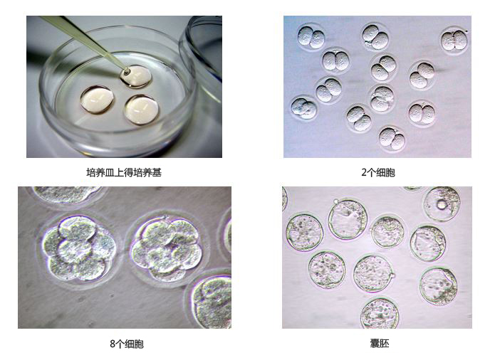 通用冻存试剂和培养基                  Mouse General Freezing and Culture Medium