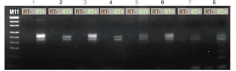 ISOIL for RNA                  从土壤提取RNA试剂盒