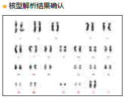 StemSure® 人多能干细胞培养基                  StemSure® hPSC Medium