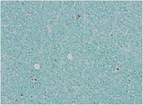 细胞凋亡in situ检测试剂盒Wako                  Apoptosis in situ Detection Kit Wako