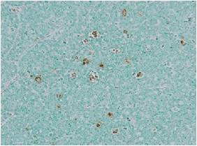 细胞凋亡in situ检测试剂盒Wako                  Apoptosis in situ Detection Kit Wako