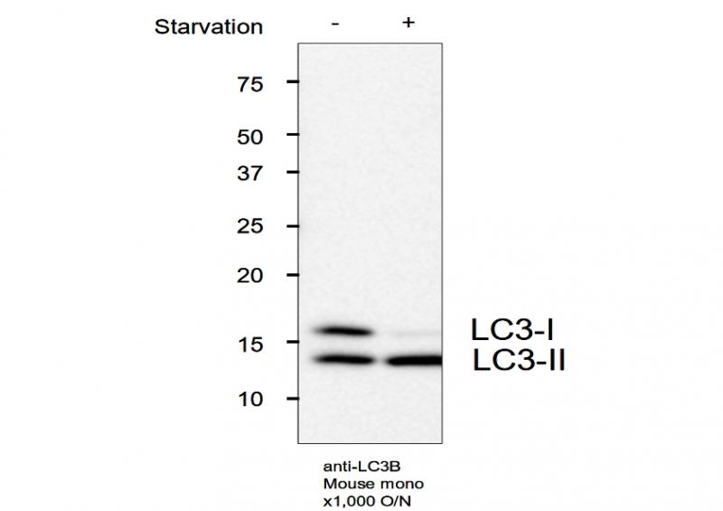抗LC3单克隆抗体（克隆号：LC3.NO6）                  Anti LC3 (Clone: LC3.No.6) monoclonal antibody