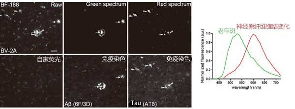 老年斑•神经原纤维缠结特异性探针BF-187，BF-188