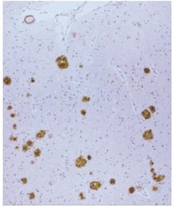 β淀粉样蛋白-免疫组织染色试剂盒                  Amyloid β-Protein Immunohistostain Kit