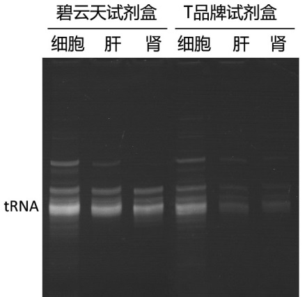 RNAeasy™动物小RNA抽提试剂盒(离心柱式)(R0028)