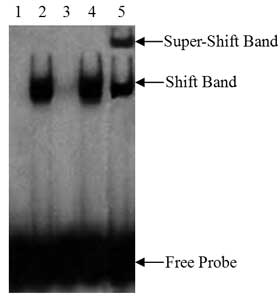 EMSA/Gel-Shift 结合缓冲液(5X)(GS005)