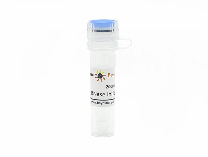 RNase Inhibitor(R0102-2kU)