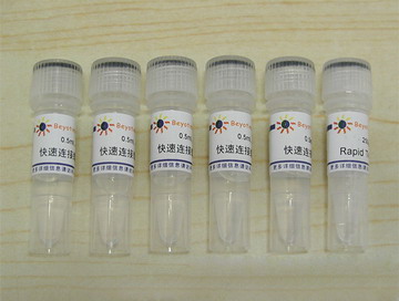 快速DNA连接试剂盒(D7003)