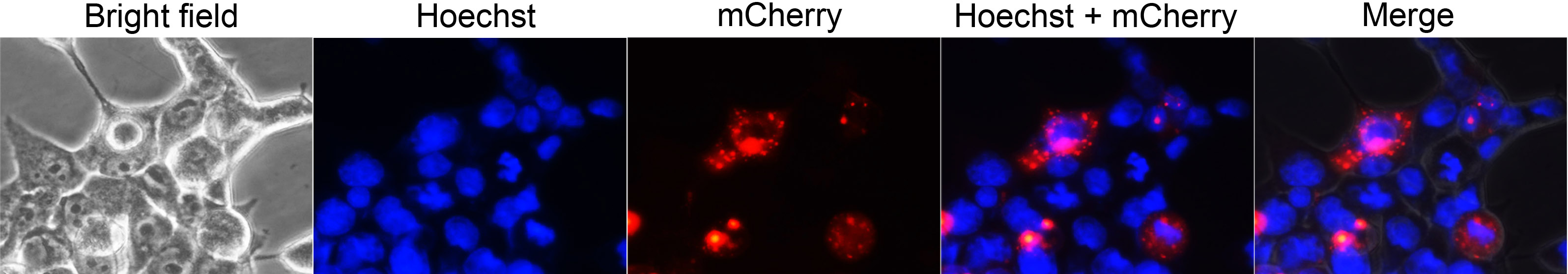 Ad-mCherry-p62(C3016-10ml)