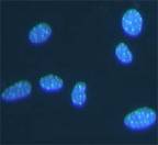 细胞凋亡－Hoechst染色试剂盒(C0003)