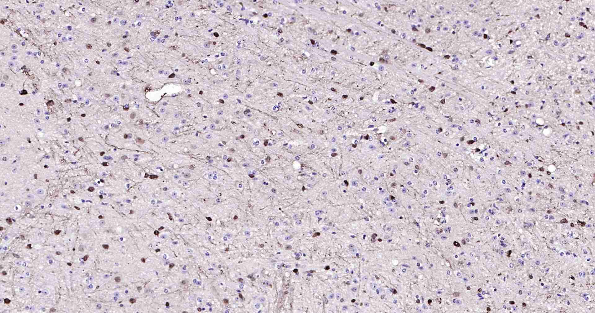 超敏二步法免疫组化检测试剂盒（兔鼠通用，即用型）