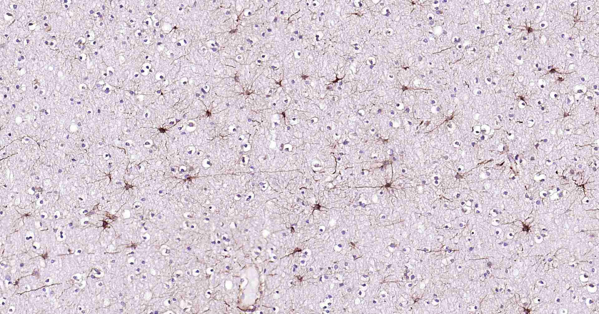 超敏二步法免疫组化检测试剂盒（兔鼠通用，即用型）