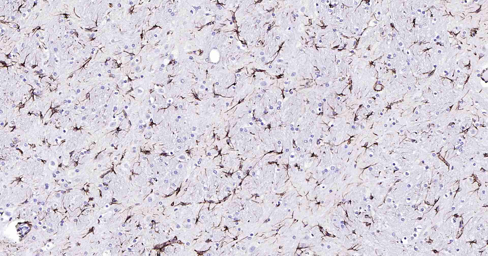 超敏二步法免疫组化检测试剂盒（兔鼠通用，即用型）